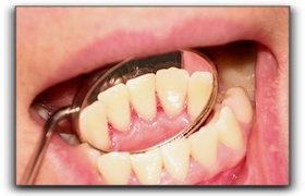 San Diego Cosmetic Dental Services