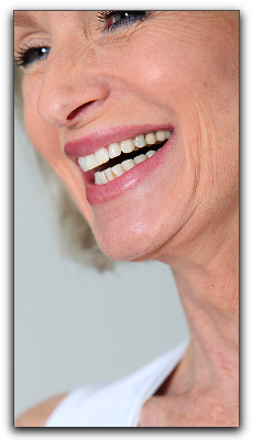 Dental Implants San Diego