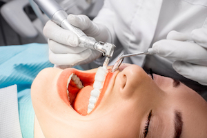 professional dental cleaning Toms River