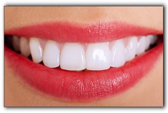 fix gummy smile Mechanicsville