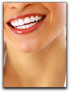 Help For Gainesville GA Tetracycline And Fluoride Staining - Porcelain Veneers