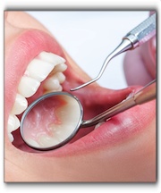 white fillings Rancho Santa Fe