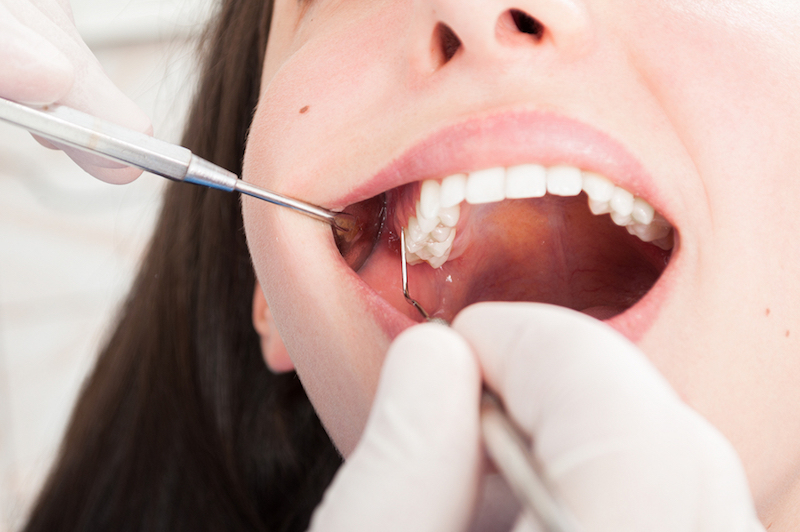 gum disease treatment Longview