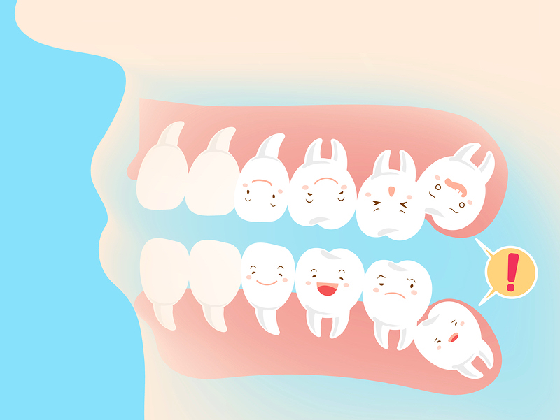 wisdom teeth Arlington