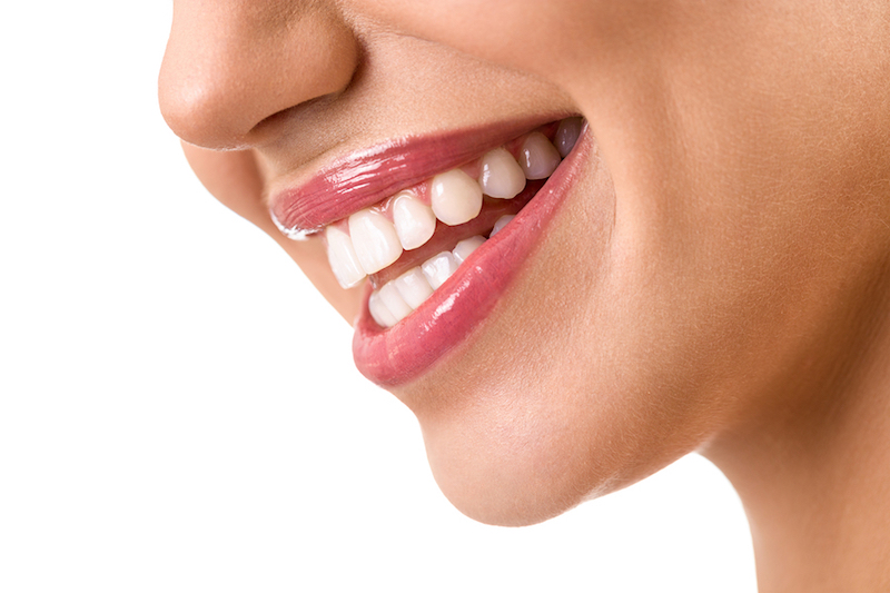 Replace metal fillings with tooth colored fillings in Pearland.