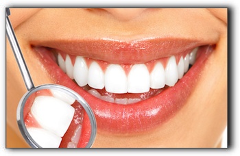 Teeth Whitening in Lone Tree