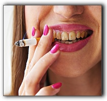 porcelain veneers cost Seattle